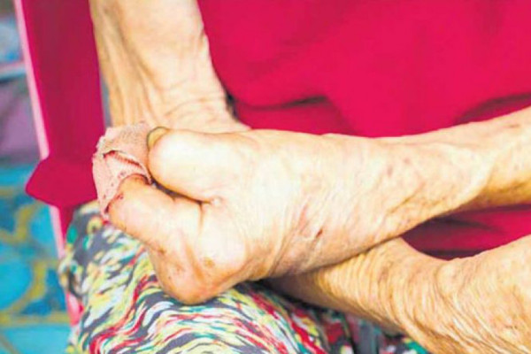 एक सय ३३ कुष्ठरोगीको सहारा बनेको आश्रम