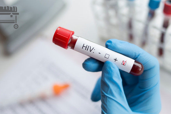 झापामा तीन वर्षमा ७५ जना एचआइभी सङ्क्रमितको मृत्यु