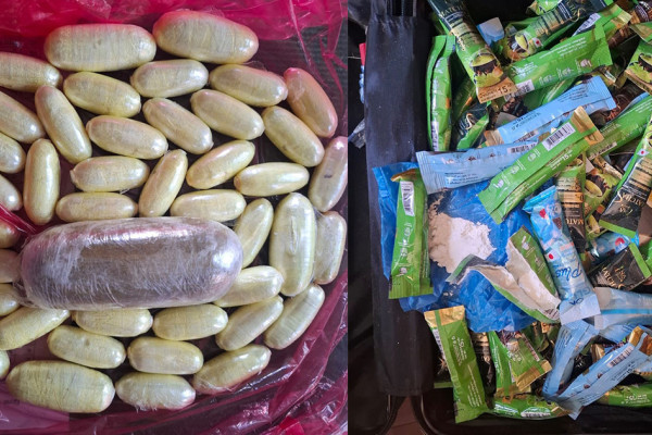 विदेशीले पेटमा लुकाइएको कोकिन बरामद