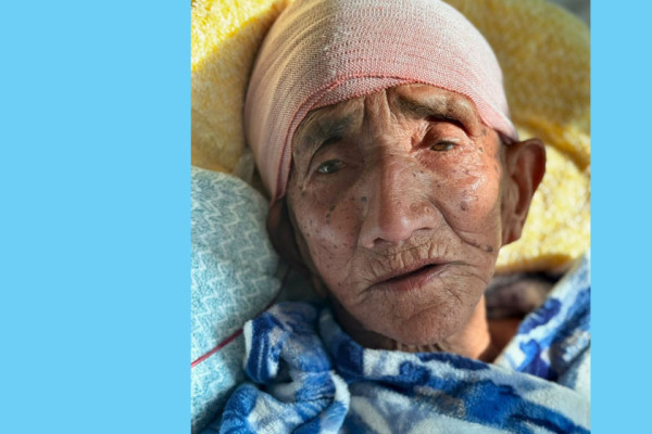 वीरमा १०३ तीन वर्षकी वृद्धाको टाउकोको सफल शल्यक्रिया