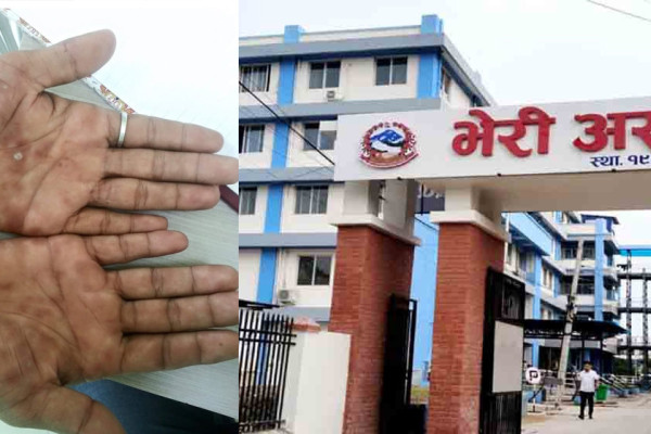 भेरी अस्पतालमा भिरिंगी रोगसम्बन्धी अनुसन्धान सुरु