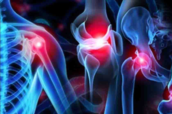 झापामा आजदेखि ‘अर्थोकोन–२०२६’ सम्मेलन